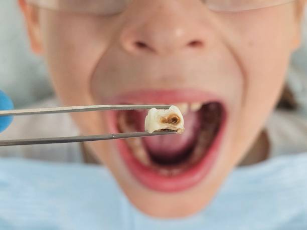 Best Weekend Emergency Dentist in Moorhead, MS